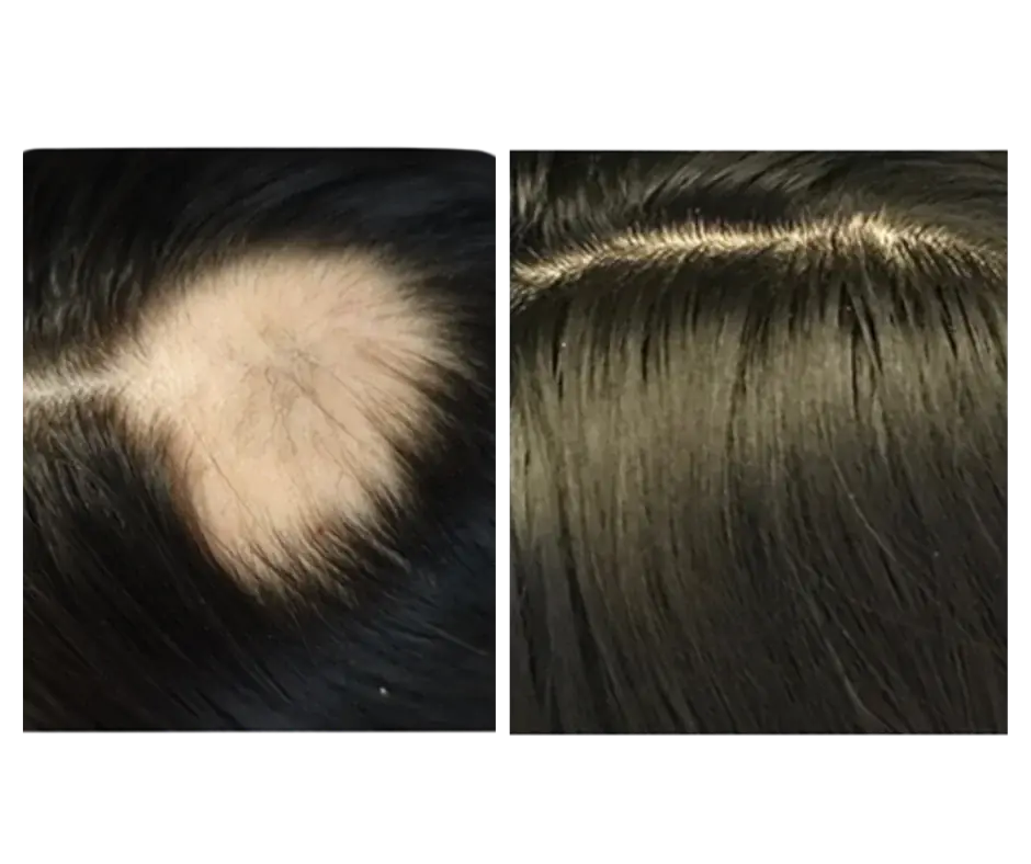 Fuller, healthier hair