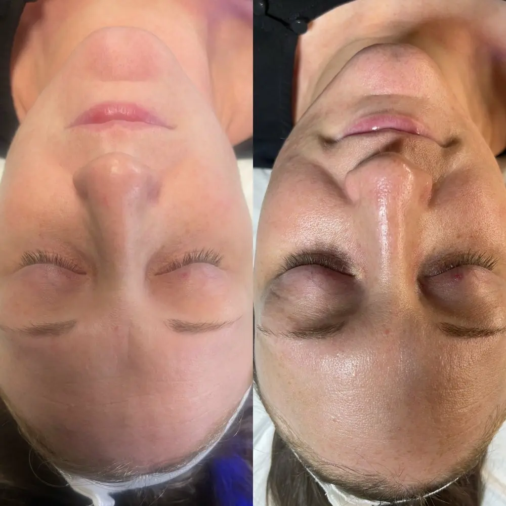 Skin results