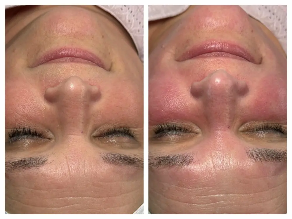 Glowing skin result