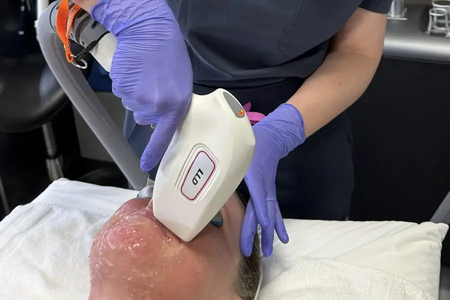 Laser hair removal treatment in Vancouver, WA