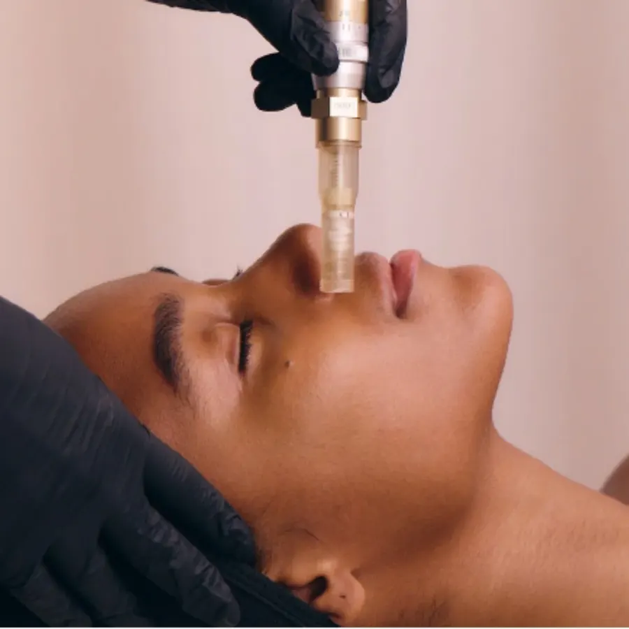 SkinStylus Microneedling device used on client face