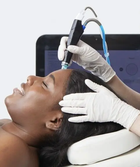 Acne HydraFacial