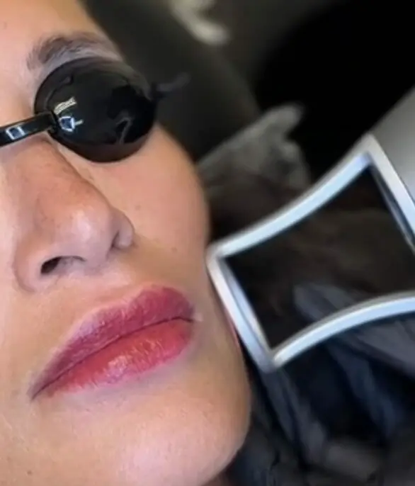 Glow Light laser rejuvenation treatment