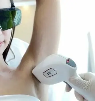 Laser hair removal treatment in Vancouver, WA
